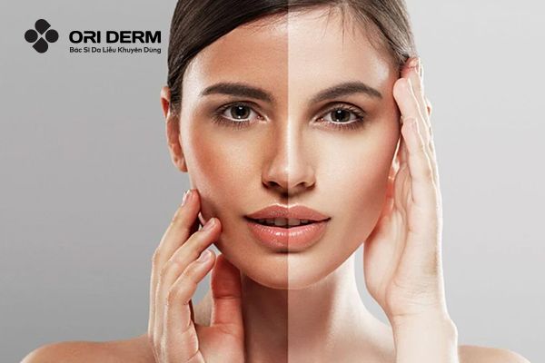 Mẹo ngăn ngừa tình trạng da không đều màu