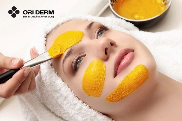 10 Cách Trị Thâm Mụn Bằng Nghệ Đơn Giản Và Hiệu Quả Tại Nhà