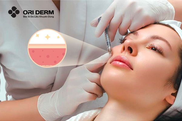 Nguyên lý hoạt động