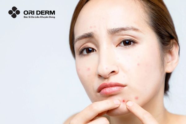 Nguyên nhân gây mụn bọc