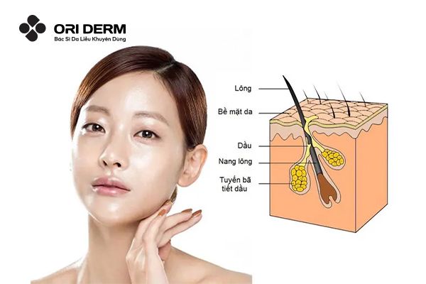 Nguyên nhân gây mụn đầu đen