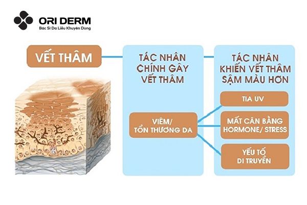 Nguyên nhân gây ra sẹo thâm