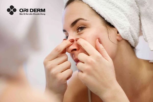 Nguyên nhân gây mụn thâm và tụ máu