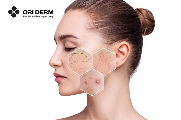 Nguyên nhân làm da mặt hư tổn