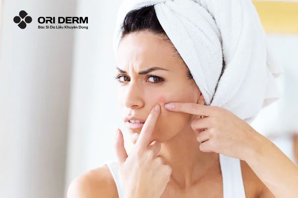 Nguyên nhân nổi mụn ở má