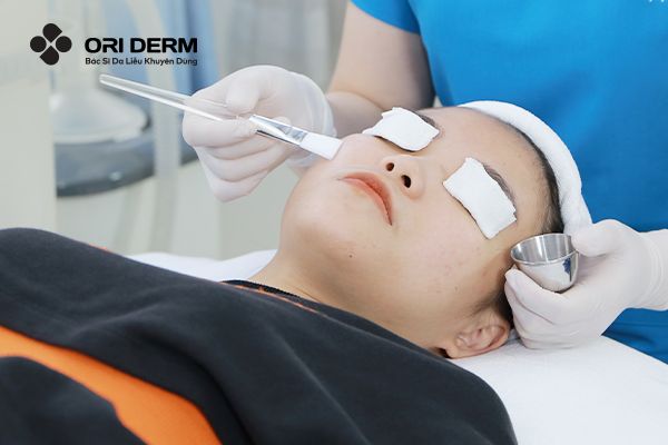 Peel Da Xong Có Nên Dùng Retinol Không? Những Điều Cần Lưu Ý