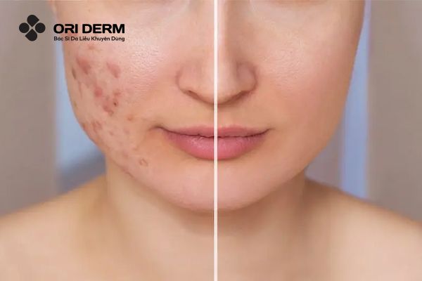 Cơ chế hoạt động của Vitamin E trong việc trị thâm