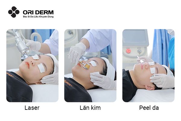 Kết hợp Vitamin E với các phương pháp khác