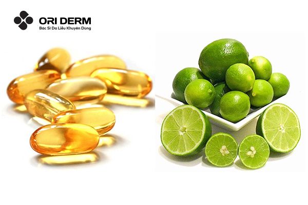 Kết hợp Vitamin E và chanh để giảm thâm mụn