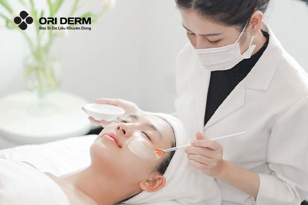 Peel da hóa học trị mụn viêm ở trán