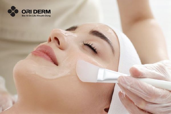 Peel da tiêu diệt các ổ mụn viêm