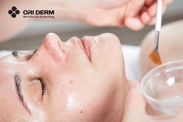 Peel da lấp đầy sẹo lõm