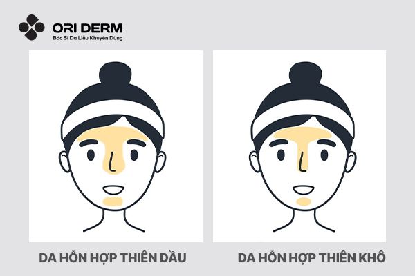 Phân loại da hỗn hợp