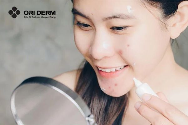 Hướng Dẫn Cách Xử Lý Mụn Viêm Hiệu Quả Và Nhanh Gọn Ngay Tại Nhà