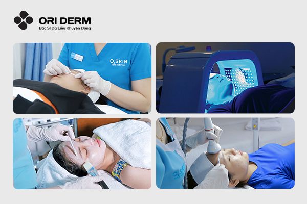 Điều trị mụn bọc bằng công nghệ cao