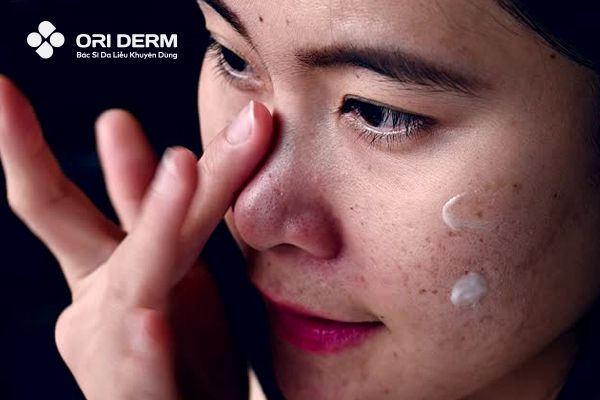 Tổng Hợp 9 Thuốc Trị Sẹo Rỗ Trên Mặt Hiệu Quả Hiện Nay