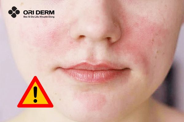 Những lưu ý khi sử dụng dầu tẩy trang mà bạn cần biết