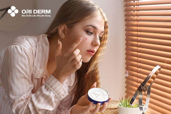 Sử dụng các sản phẩm đặc trị mụn