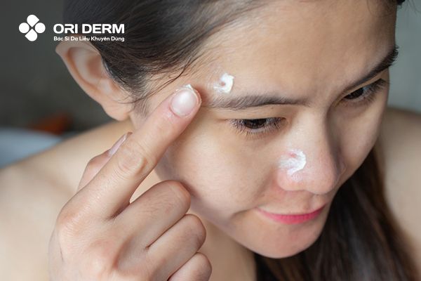 Sử dụng thuốc bôi để làm mờ sẹo thâm