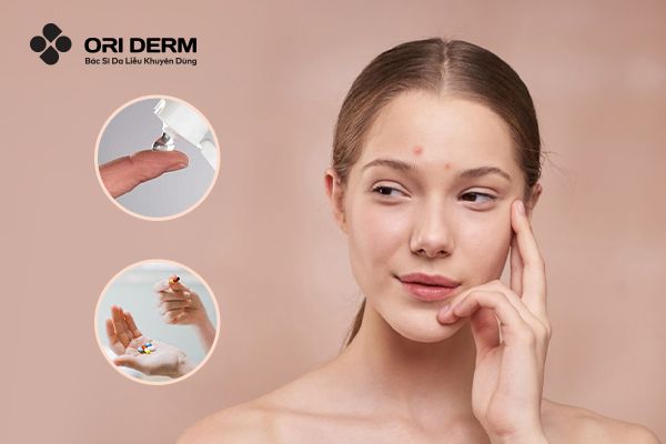 Sử dụng thuốc trị mụn
