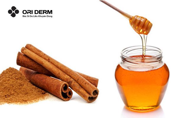 Mặt nạ trị mụn đầu đen mật ong và quế