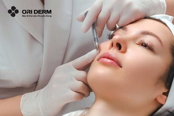 Cách trị mụn ẩn mụn đầu trắng bằng tiêm steroid