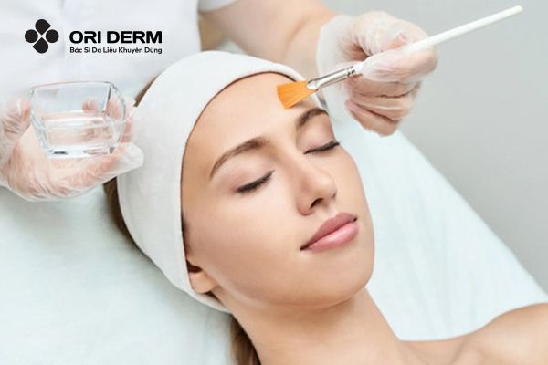 Bước 2: Tiến hành bôi dung dịch peel da mụn viêm