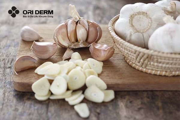 Đắp tỏi tươi để giảm tình trạng sưng viêm