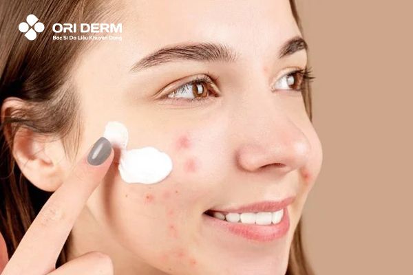 Cách trị viêm da mủ bằng thuốc