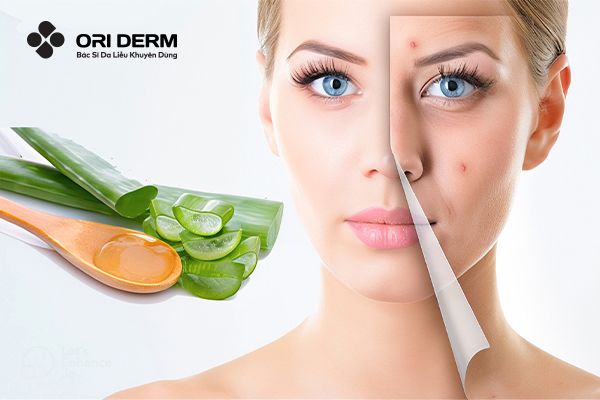 Bỏ Túi 07 Cách Dưỡng Ẩm Cho Da Khô Hiệu Quả Và Dễ Thực Hiện Tại Nhà