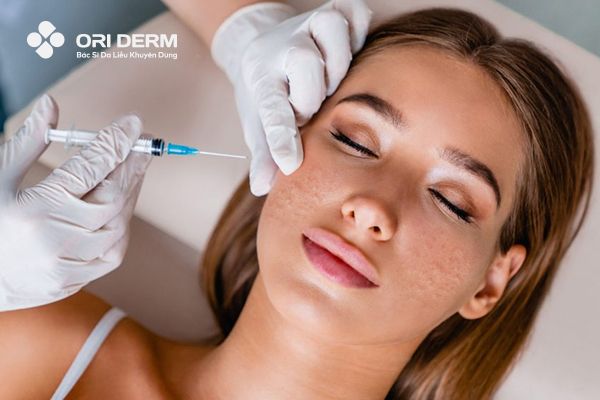 Tiêm Meso Trị Sẹo Rỗ Có Hiệu Quả Không? Cần Lưu Ý Điều Gì?