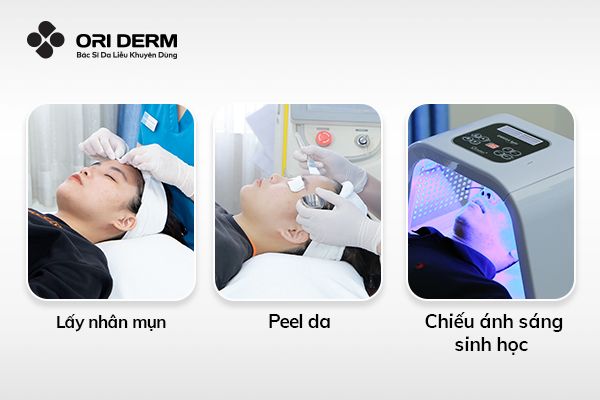 Trị mụn ẩn dưới cằm với phương pháp y khoa