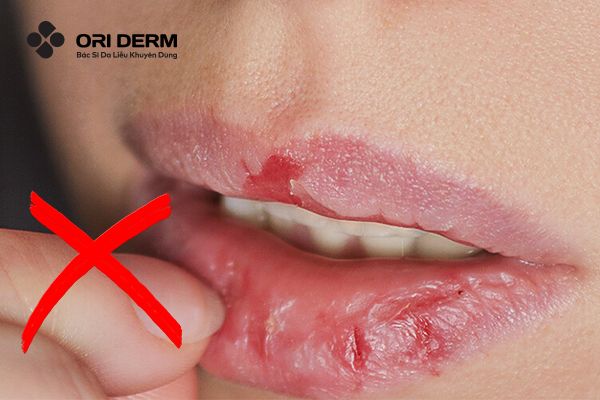 Lưu ý khi tẩy tế bào chết môi tại nhà