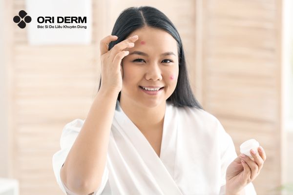 Lưu ý khi trị mụn ẩn trên trán