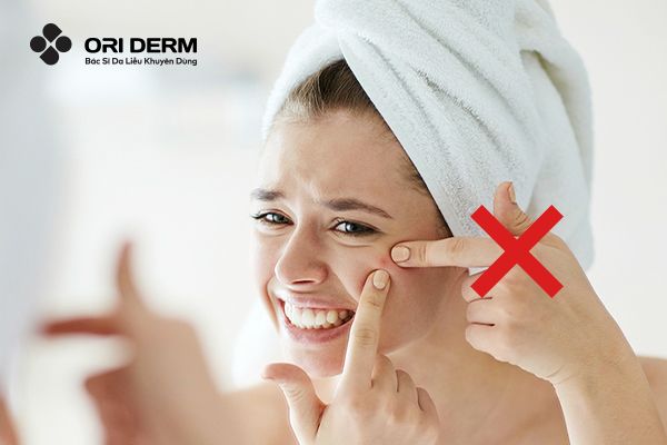 Khi trị mụn viêm đỏ không nhân, cần lưu ý gì?