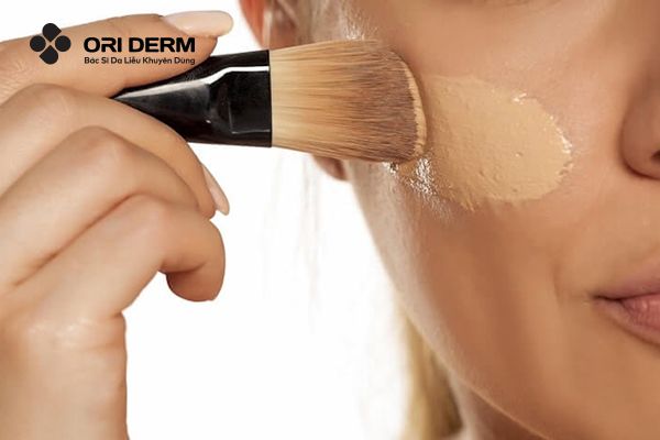 Nguyên nhân gây mụn ẩn mụn đầu trắng