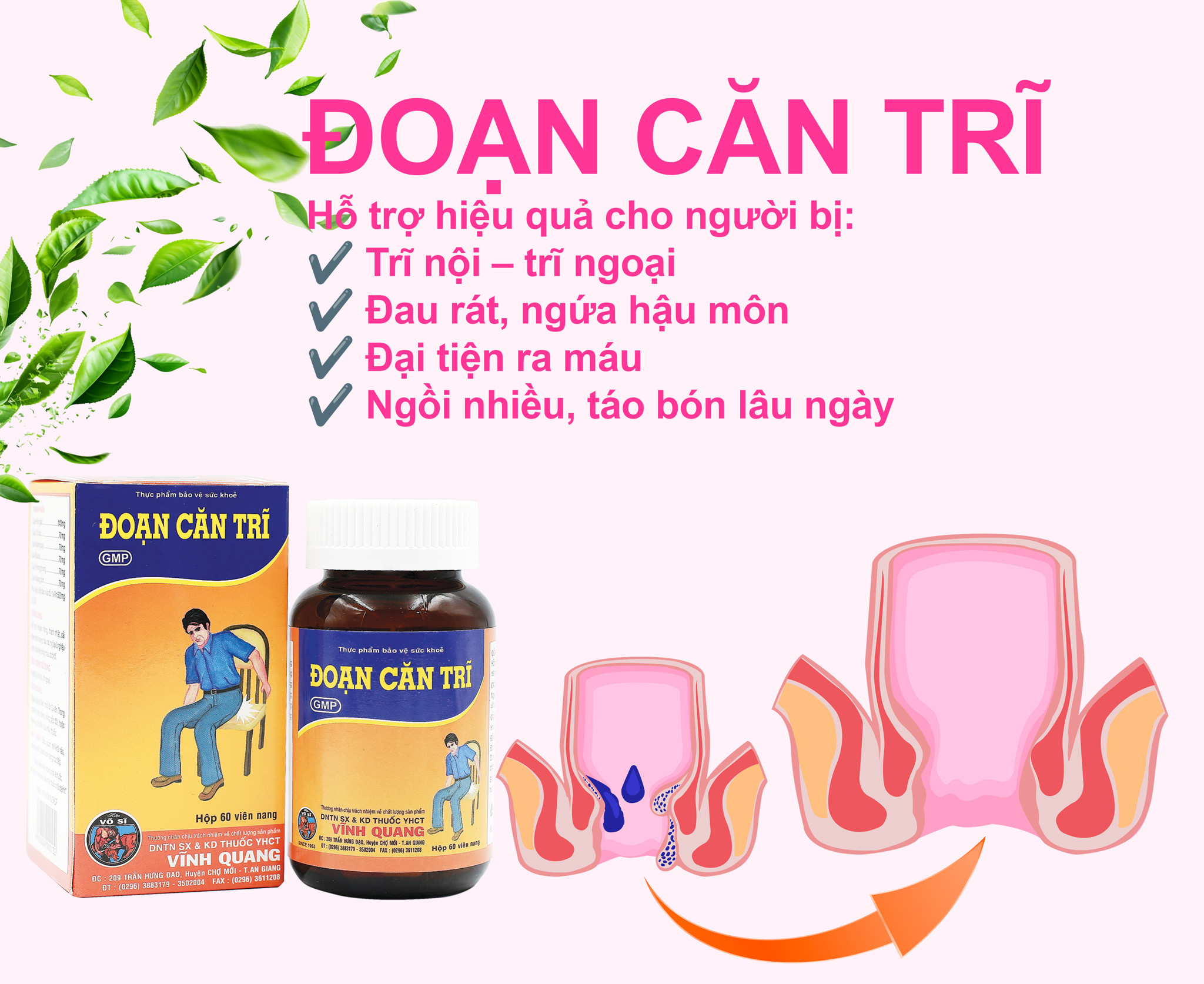 Bệnh trĩ có nên để lâu- Đông Dược Vĩnh Quang – Viquapharm