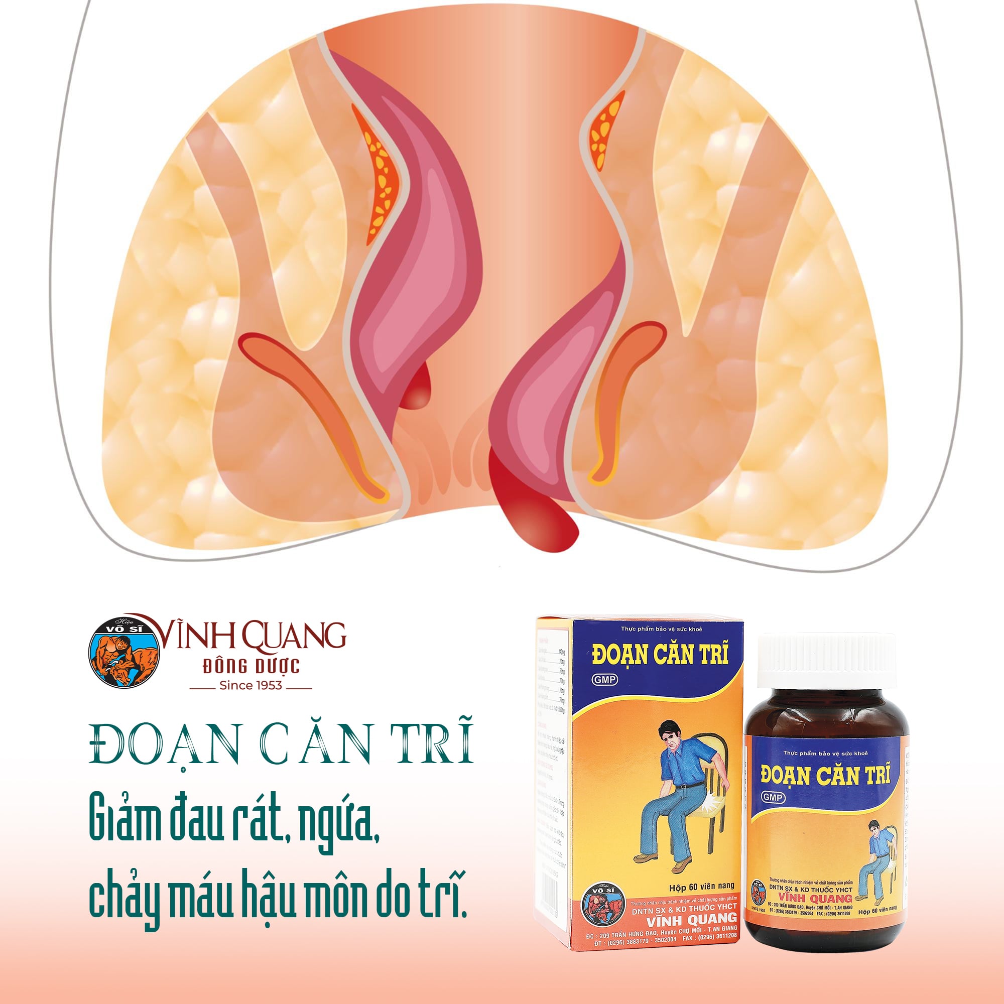 Đoạn Căn Trĩ – Hỗ trợ cải thiện bệnh trĩ từ thảo dược