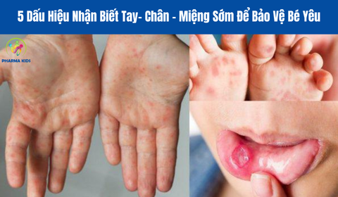 Bệnh Tay Chân Miệng: 5 Dấu Hiệu Nhận Biết Sớm Để Bảo Vệ Bé Yêu