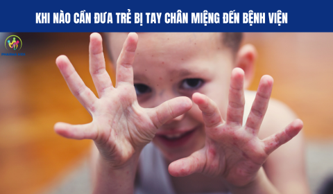 KHI NÀO CẦN ĐƯA TRẺ BỊ TAY CHÂN MIỆNG ĐẾN BỆNH VIỆN