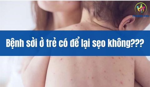 3. Cách Điều Trị Bệnh Sởi Không Để Lại Sẹo