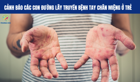 CẢNH BÁO CÁC CON ĐƯỜNG LÂY TRUYỀN BỆNH TAY CHÂN MIỆNG Ở TRẺ