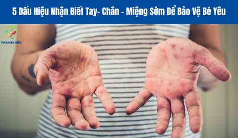 Phòng Ngừa Bệnh Tay Chân Miệng: Những Biện Pháp Hiệu Quả Mẹ Cần Nắm Rõ