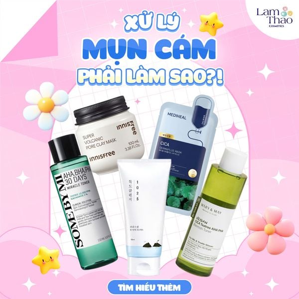 XỬ LÝ MỤN CÁM TRÊN MẶT CẦN PHẢI LÀM GÌ?