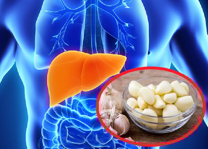 Giải đáp: Ăn tỏi có tốt cho gan không?