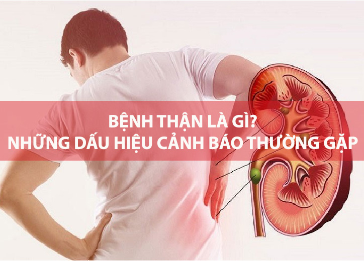 Bệnh thận là gì? Những dấu hiệu cảnh báo thường gặp