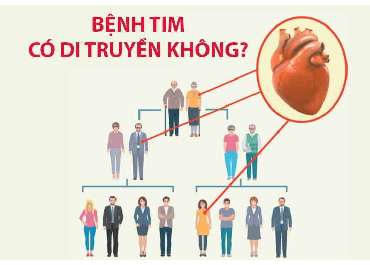Bệnh tim có di truyền không? Yếu tố nguy cơ và cách phòng tránh