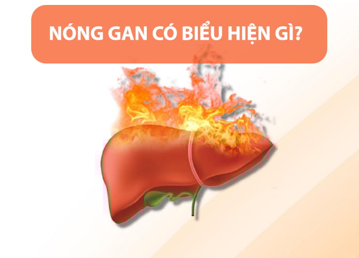 Nóng gan có biểu hiện gì? Nguyên nhân do đâu?