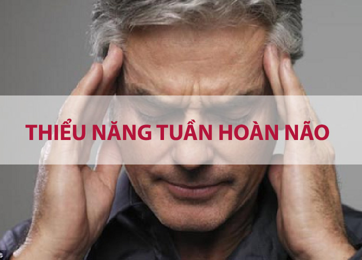 Thiểu năng tuần hoàn não là gì? Tìm hiểu nguyên nhân và cách phòng ngừa