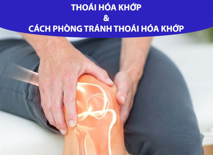 Thoái hóa khớp và cách phòng tránh thoái hóa khớp hiệu quả